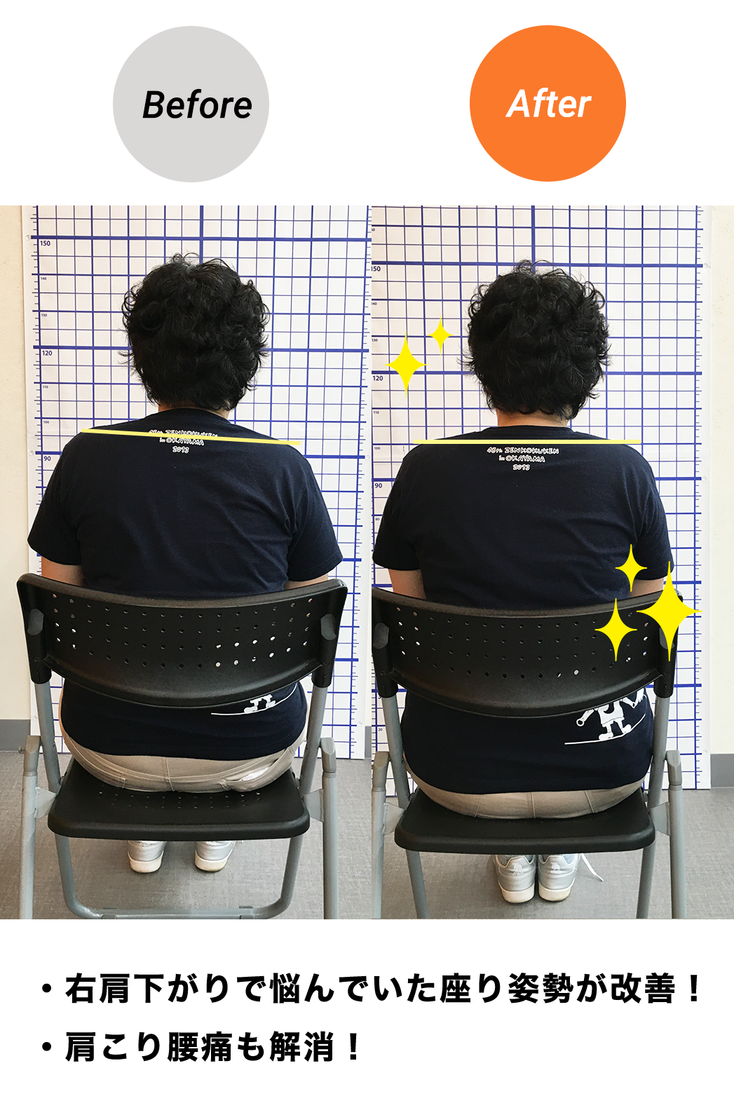 BeforeAfter