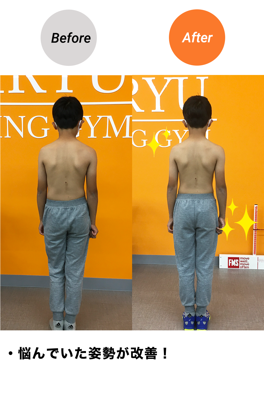 BeforeAfter