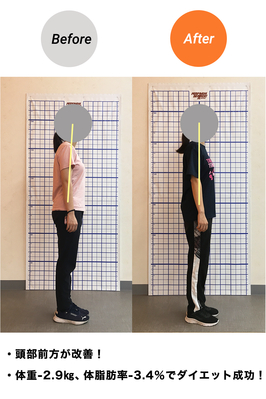 BeforeAfter