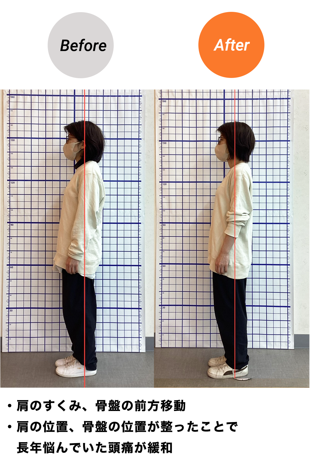 BeforeAfter